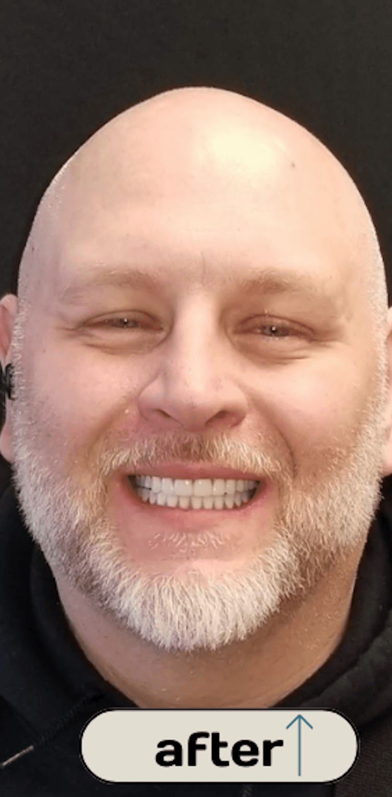 Shawn-s-Story-After-Image