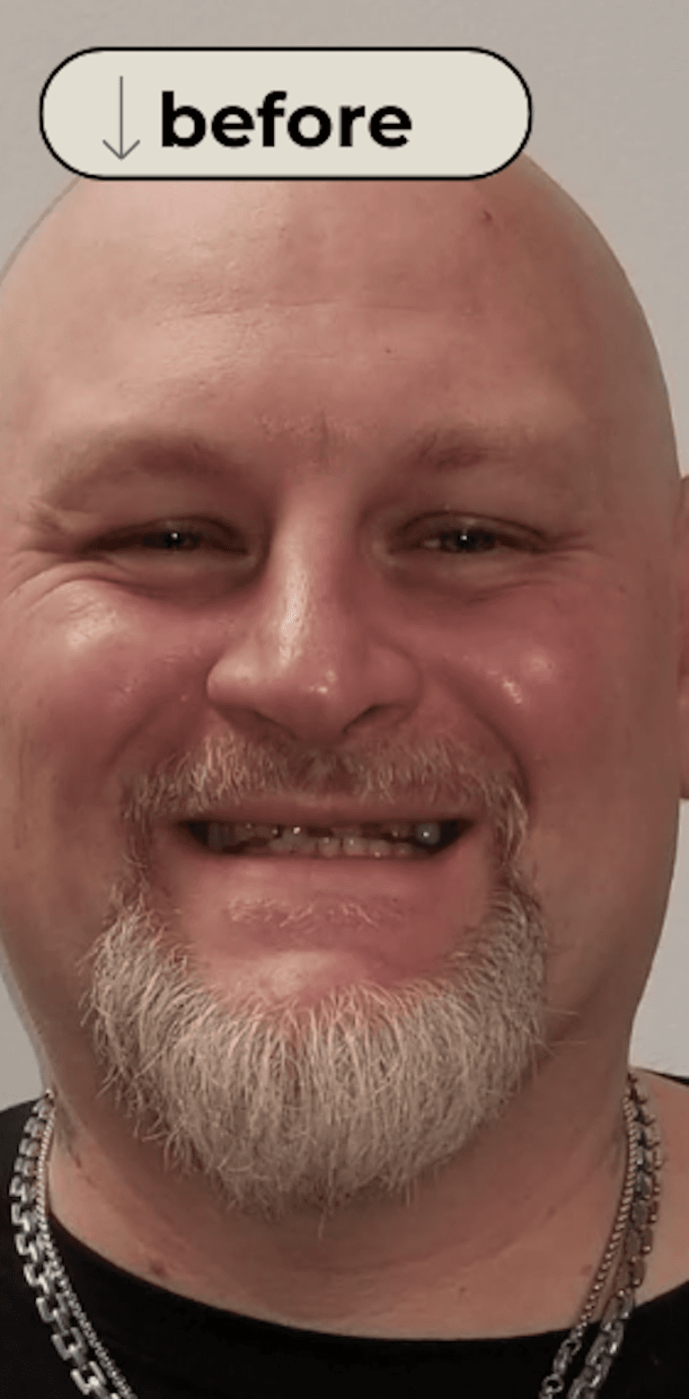 Shawn-s-Story-Before-Image
