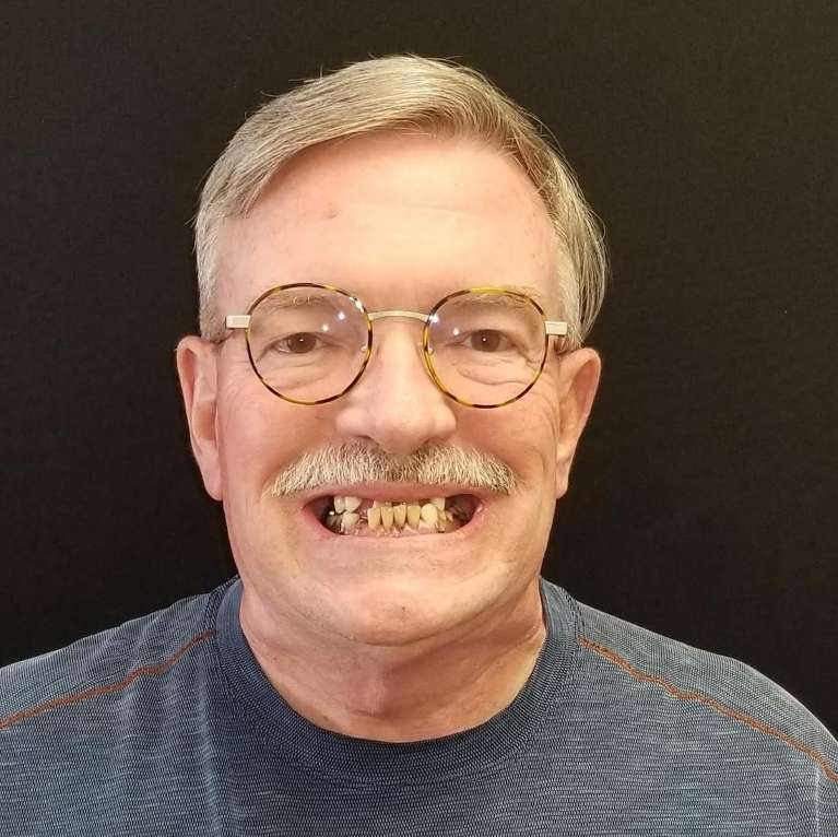Daniel-s-Story-Before-Image
